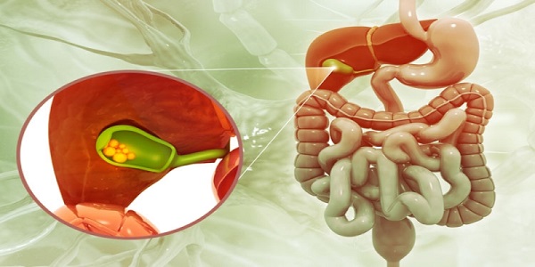 Gallbladder Stones Diagnosis - Dr. Kartick Das