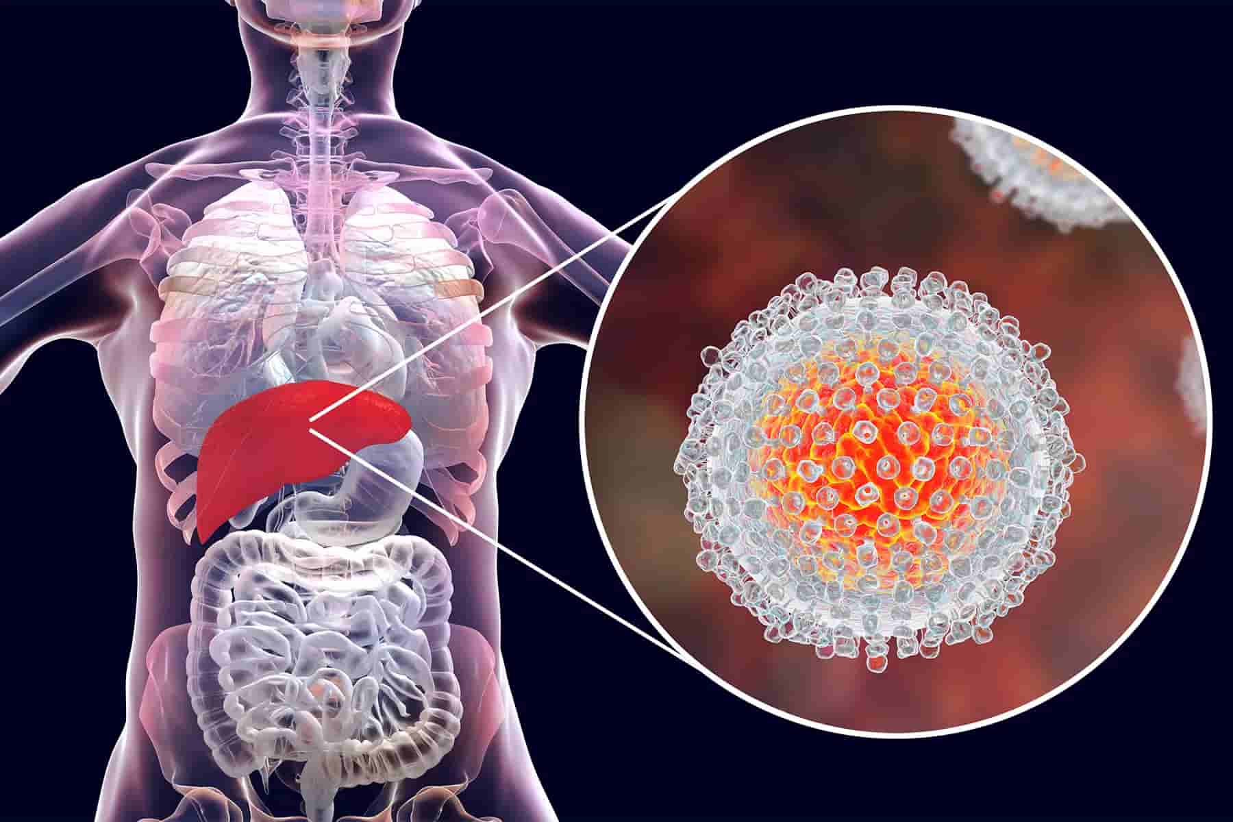 Liver Problems & Fatty Liver Care - Dr. Kartick Das