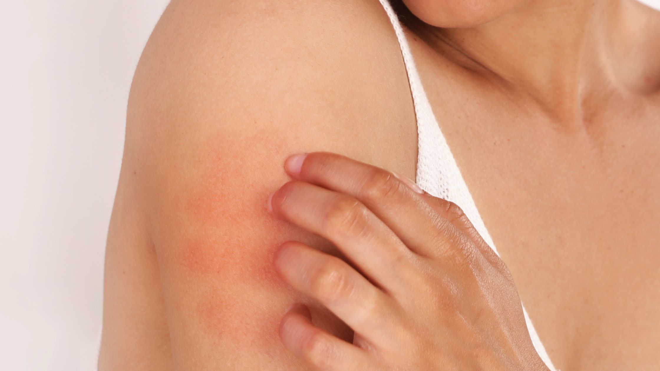 Skin Diseases & Allergy Diagnosis - Dr. Kartick Das